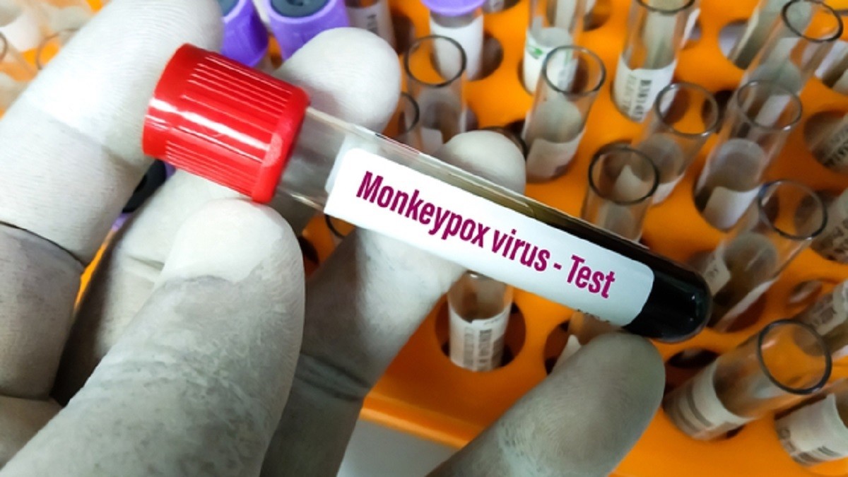 Monkey Pox outbreak : Health emergency Declared by  World Health Organization (WHO)